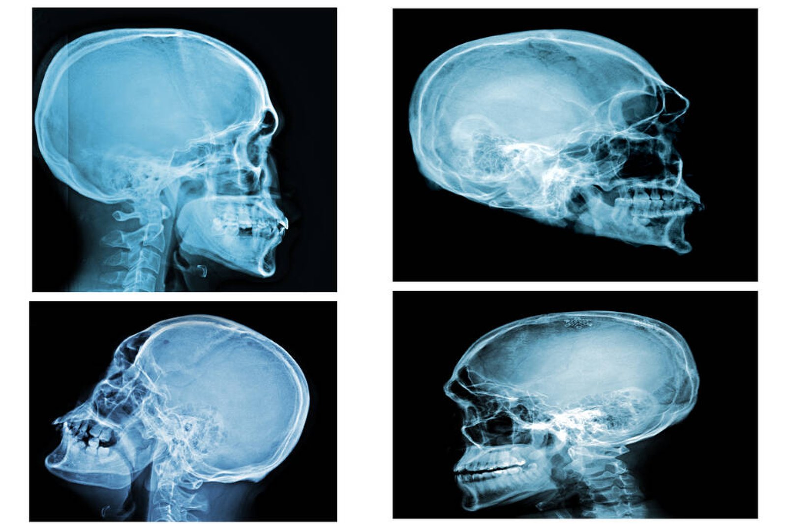 Post Mortem Facial Imaging